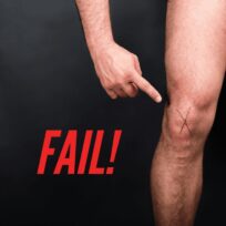 Acl rehab fail