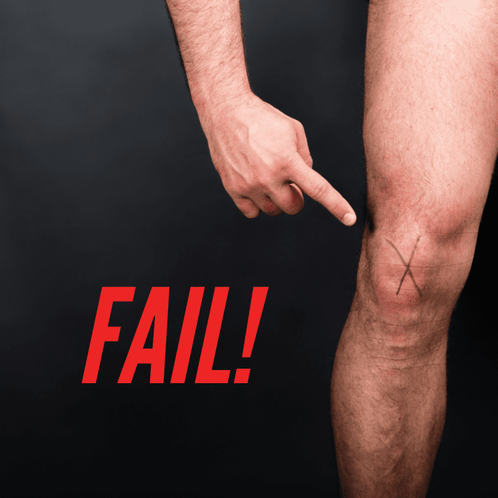 ACL Rehab ACL Rehab