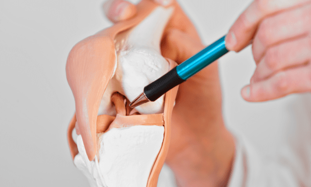 ACL断裂の臨床パターン