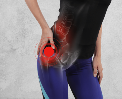 Hip pain in runners webinar cta