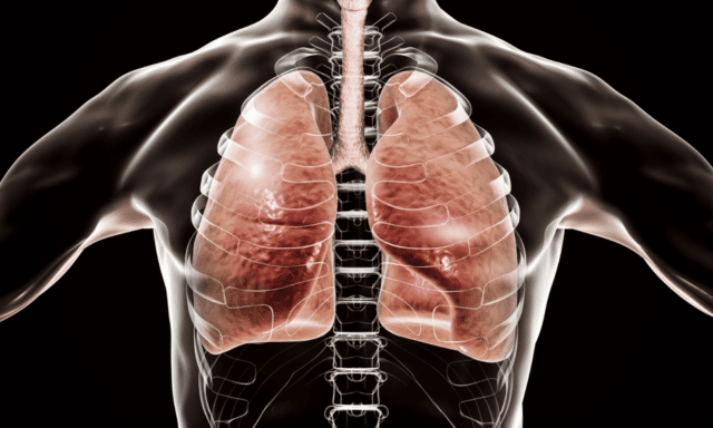 fisioterapia respiratória