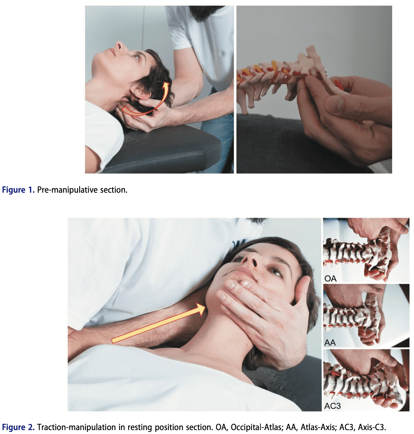 Závraty pri manipulácii s krčnou chrbticou