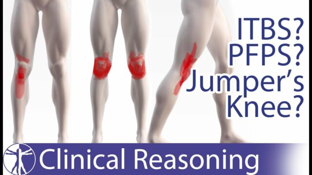 Knee pain differential diagnosis