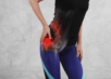 hip pathologies