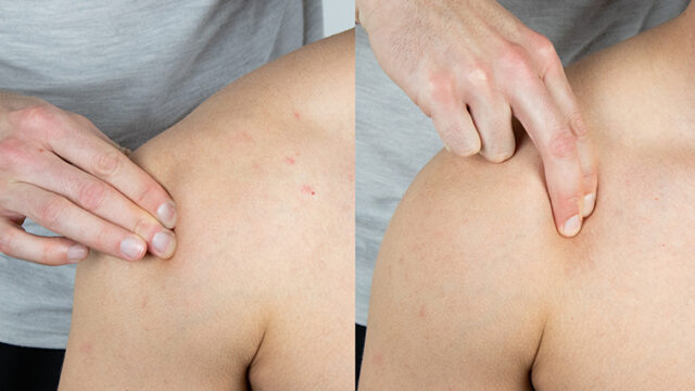 Coracoid Pain Test