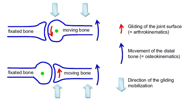 Concaveconvex