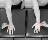 Cartes du dermatome