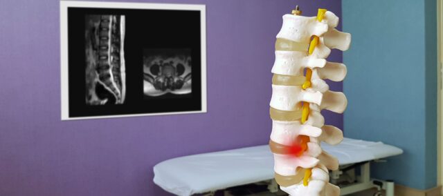 Øvelser i motorisk kontrol