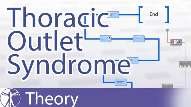 Thoracic Outlet Syndroom uitgelegd