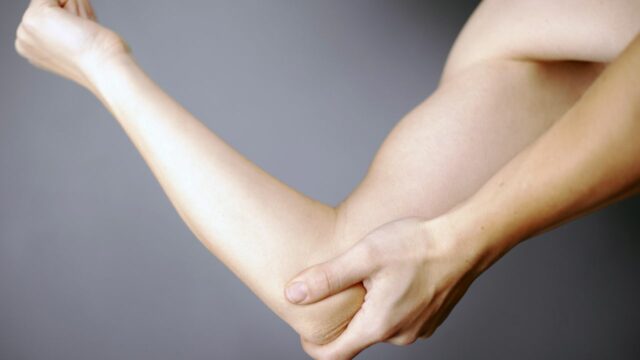 Epicondilalgia medial