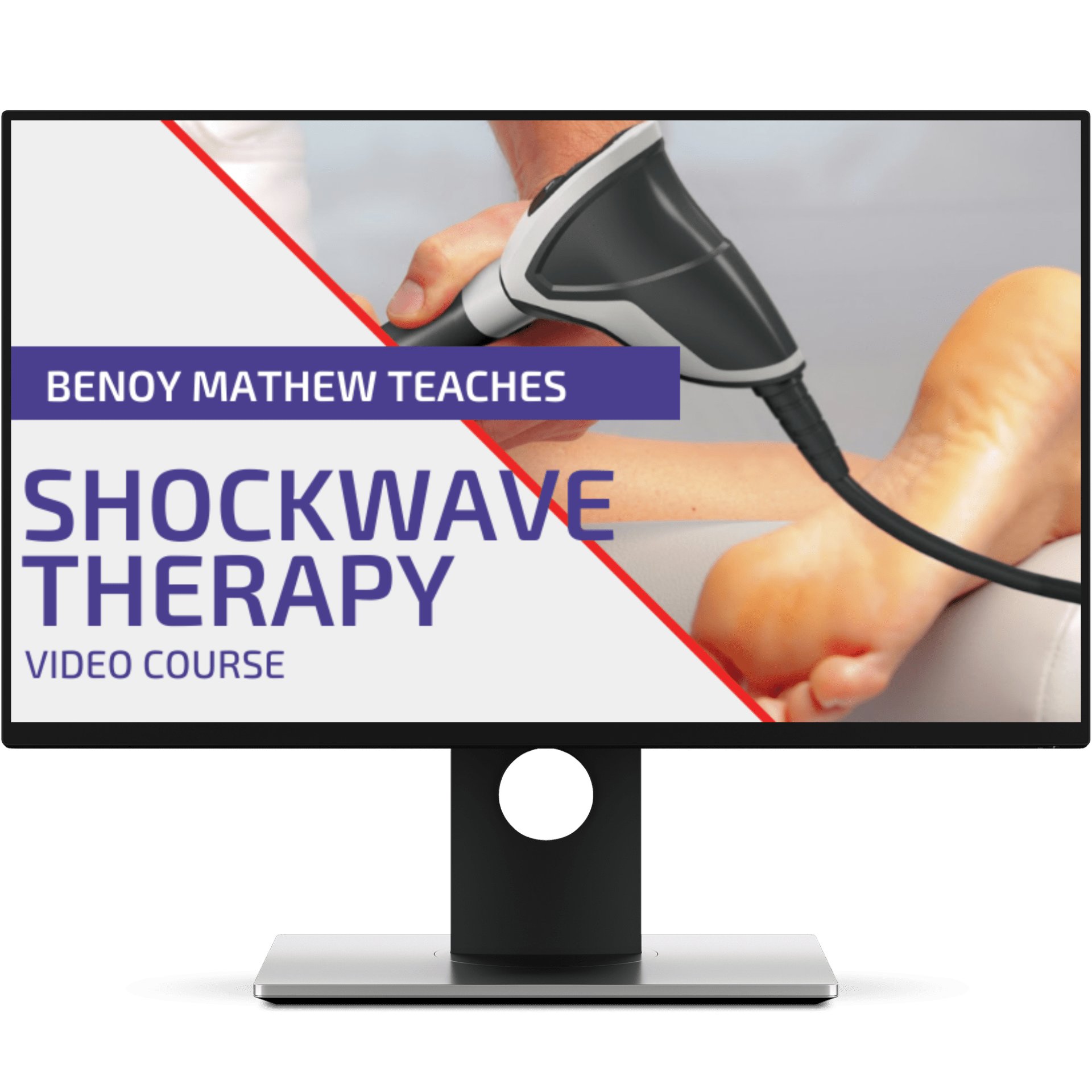 The Role of Shockwave Therapy in the Management Tendinopathy