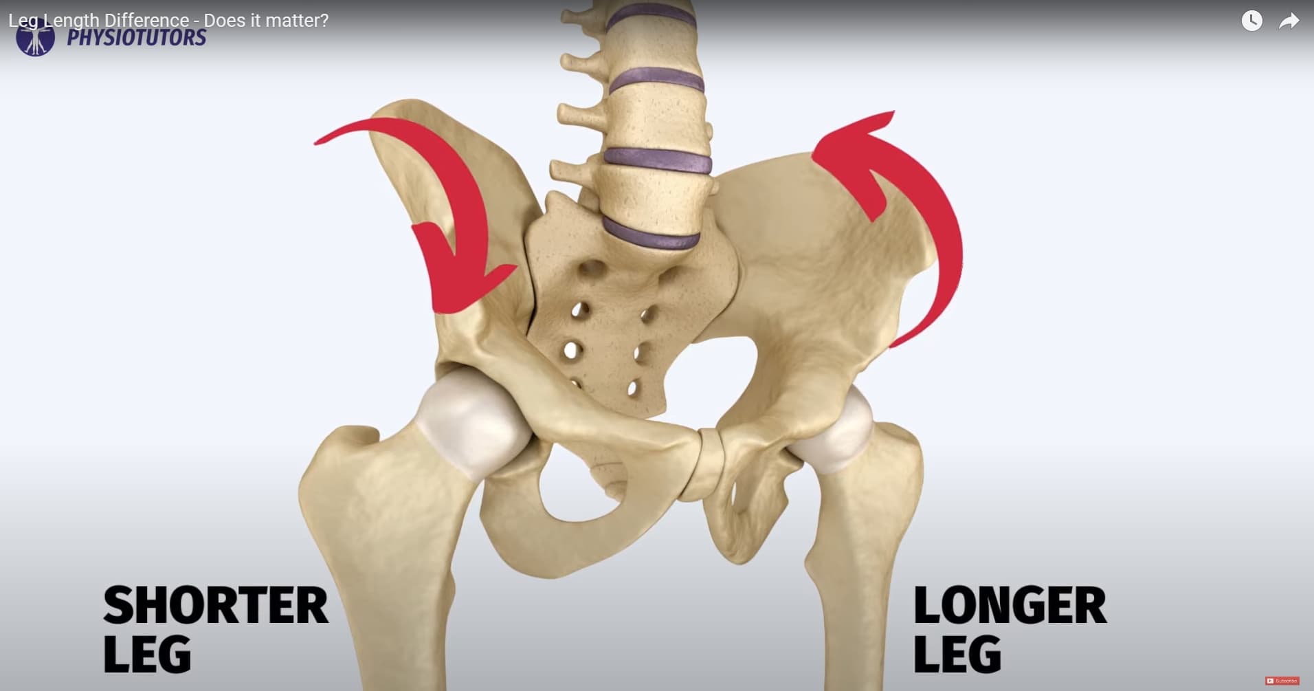 Pelvic torsion animation