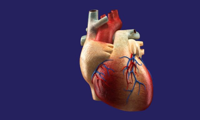Syndrome coronarien aigu