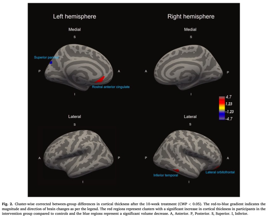 Hersenaanpassingen bij nekpijn