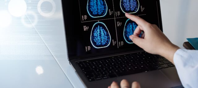 Educazione alla neuroscienza del dolore (1)
