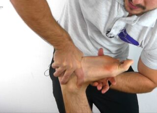 Line of chopart joint play thumbnail