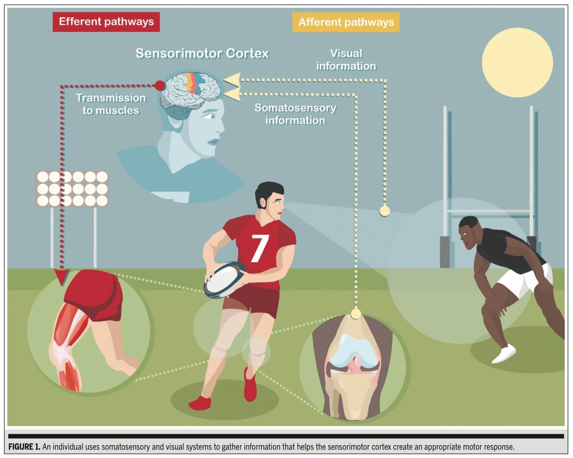 前交叉韧带损伤后的感觉运动功能障碍
