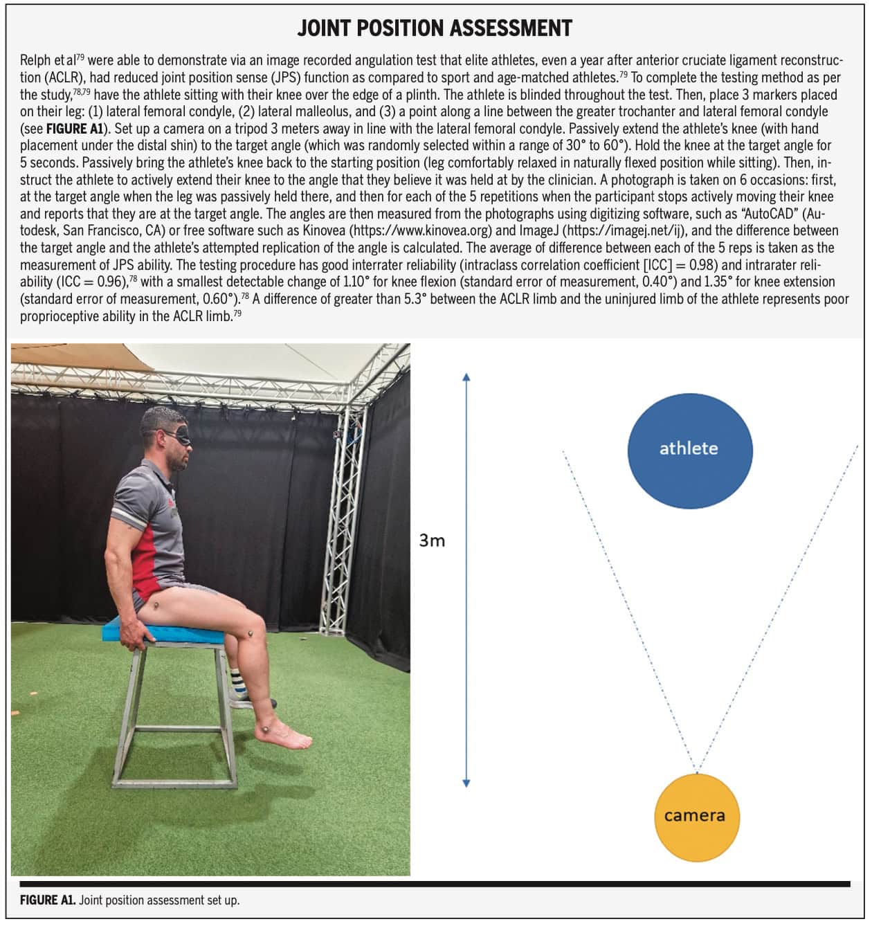 前交叉韧带损伤后的感觉运动功能障碍