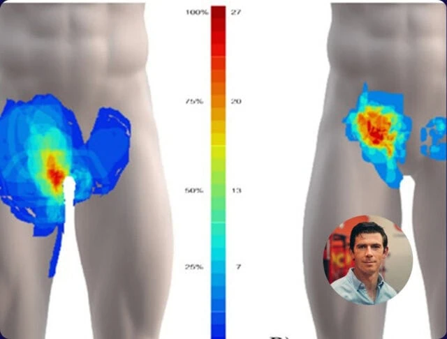 Prévention des blessures à l’aine