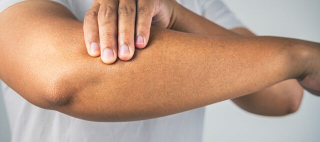 Allenamento di neuroplasticità del tendine per l’epicondilalgia laterale (1)